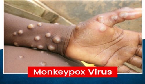 Islamic Virtues and not Vaccines are the Strongest Defense against Monkeypox Virus